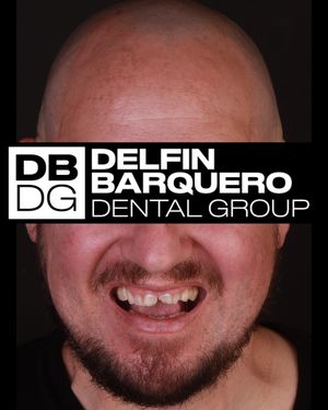 Image post by @drdelfinbarquero on Instagram