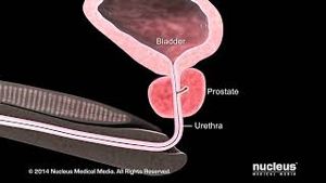 Video post by @nucleusmedicalmedia on YouTube