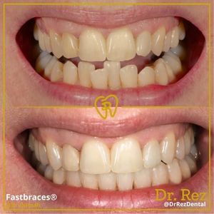 Image post by @drrezdental on Facebook
