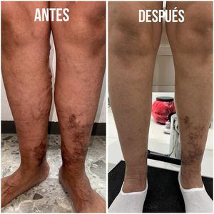 Image post by @dr.vicentevascular on Instagram