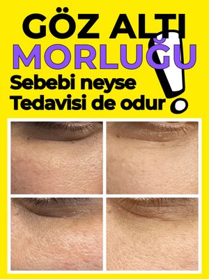 Image post by @drozlemteberik on Instagram