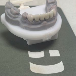 Image post by @fahaddentist on Instagram