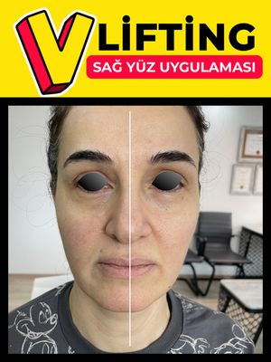 Image post by @drozlemteberik on Instagram