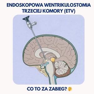 Image post by @neurochirurg_litak on Instagram