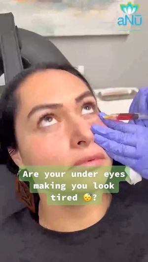 Video post by @anuaestheticsandwellness on Instagram