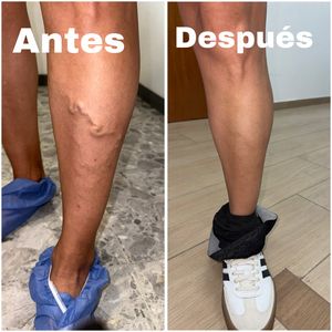 Image post by @dr.vicentevascular on Instagram