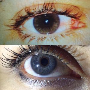 Image post by @irexlaser on Instagram