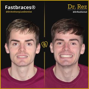 Image post by @drrezdental on Facebook