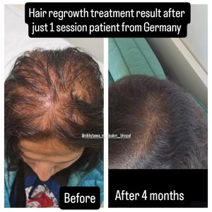 Image post by @nikkybawamedisalonbhopal on Instagram
