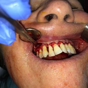 Image post by @dentamerzifon on Instagram
