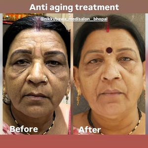 Image post by @nikkybawamedisalonbhopal on Instagram