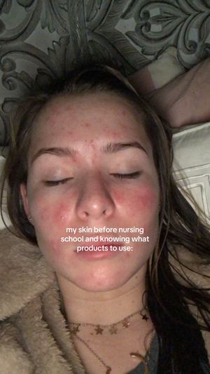 Video post by @chloevanberkel on TikTok