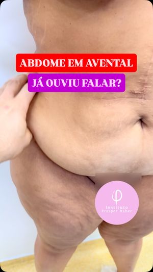 Video post by @drpresperd on Instagram