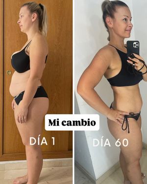 Image post by @lipedema.su on Instagram