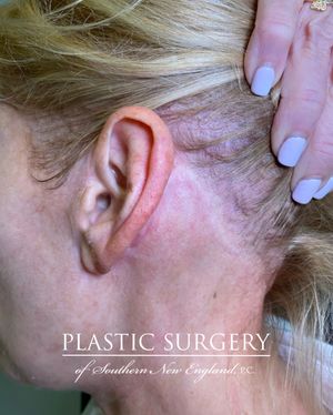 Image post by @therealplasticsurgeon on Instagram