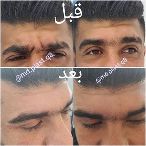 Image post by @drhsnaziz on Instagram