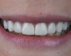 Image post by @sharpdentistry on Instagram