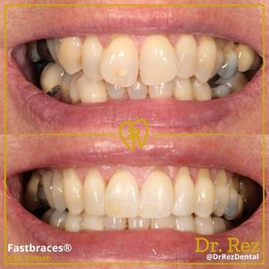 Image post by @drrezdental on Facebook
