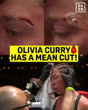 Image post by @daznboxing on Instagram