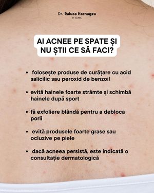 Image post by @dr.ralucaharnagea on Instagram