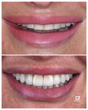 Image post by @sharpdentistry on Instagram