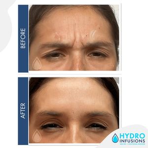 Image post by @hydromedspa on Facebook