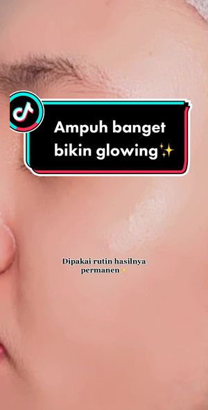 Video post by @lili.refliskin on TikTok