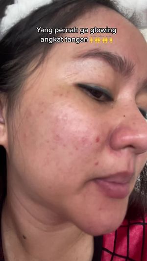 Video post by @lili.refliskin on TikTok