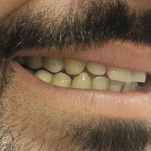 Image post by @dentamerzifon on Instagram