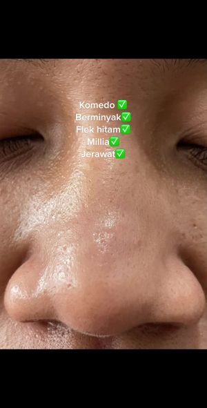 Video post by @lili.refliskin on TikTok