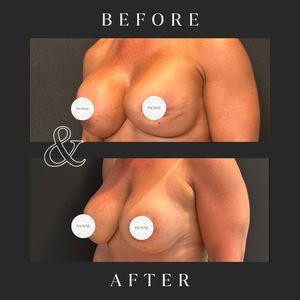 Image post by @therealplasticsurgeon on Instagram