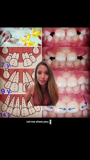 Video post by @weisstorortho on TikTok