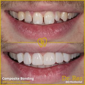 Image post by @drrezdental on Facebook