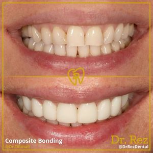 Image post by @drrezdental on Facebook