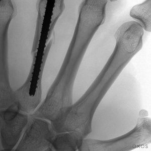 Image post by @oxosmedical on Instagram