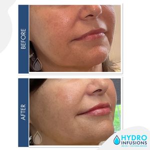 Image post by @hydromedspa on Facebook