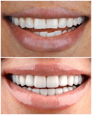 Image post by @sharpdentistry on Instagram
