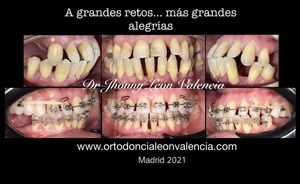 Image post by @dr.leon_valencia on Instagram