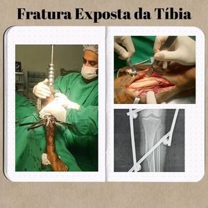 Image post by @drlucianofontes on Instagram