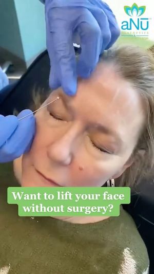 Video post by @anuaestheticsandwellness on Instagram