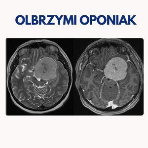 Image post by @neurochirurg_litak on Instagram