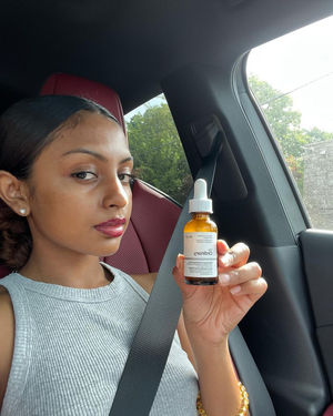 Image post by @skeepers_us on Instagram