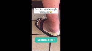 Video post by @thebunionking on YouTube