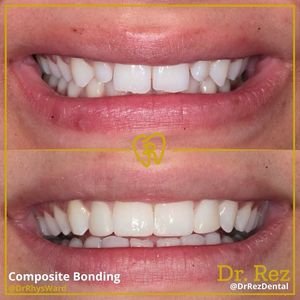 Image post by @drrezdental on Facebook