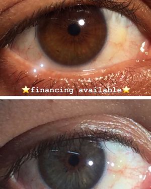 Image post by @irexlaser on Instagram