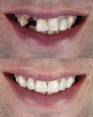 Image post by @fahaddentist on Instagram