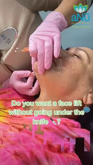 Video post by @anuaestheticsandwellness on Instagram