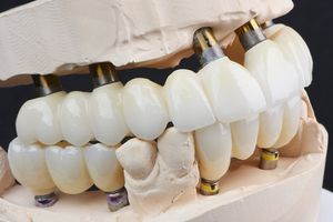 Image post by @sharpdentistry on Instagram