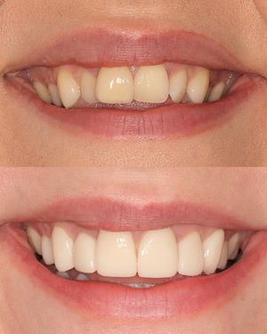 Image post by @fahaddentist on Instagram