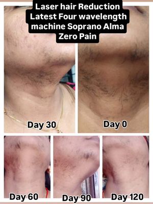 Image post by @nikkybawamedisalonbhopal on Instagram